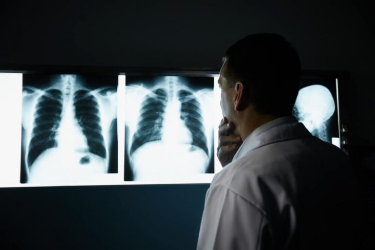 Pneumologista analisando Raio X