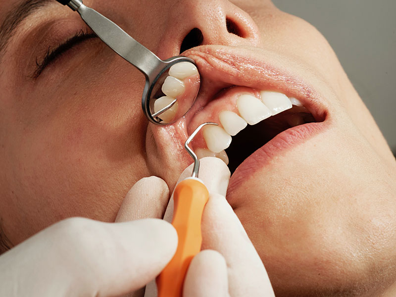 Dentista especialista em dentística realizando clareamento dentário em paciente.