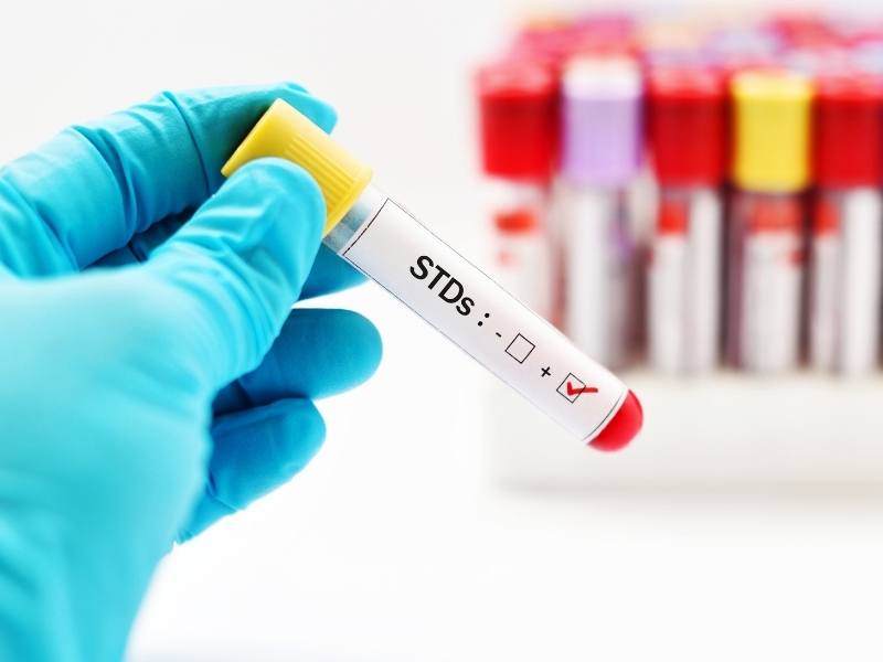 Exame para realização de testes de DST.