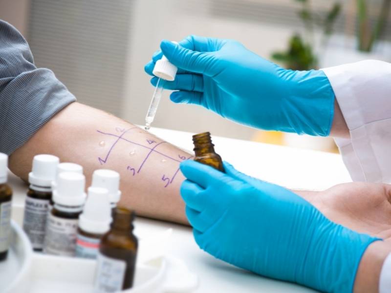 Médico realizando teste alérgico em pele de paciente.
