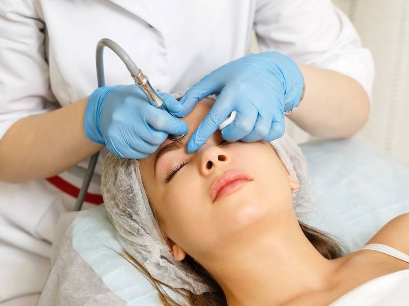 Mulher jovem realizando procedimento estético para tratamento de acnes.