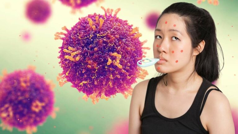 Imagem ilustrativa de virus do sarampo e menina doente com o sarampo.