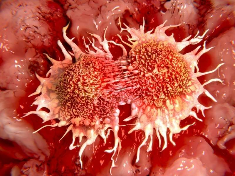 Ilustração de célula cancerígena.