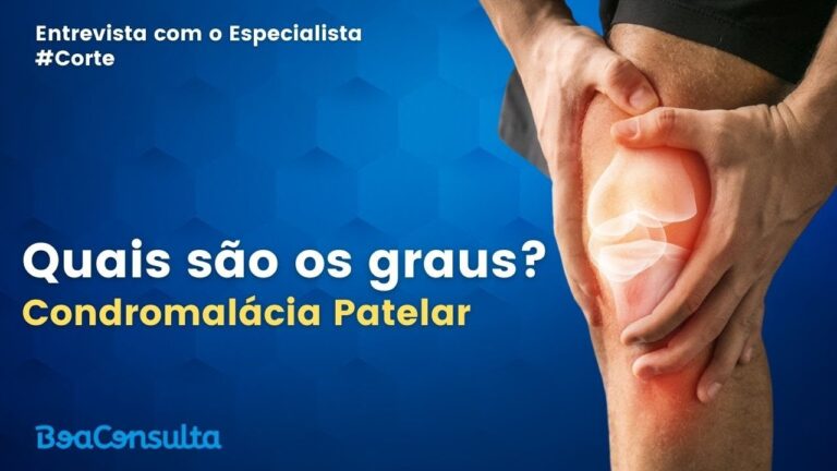 Graus da Condromalácia Patelar.