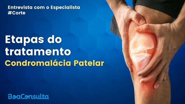 Explicação de quais são as etapas do tratamento de Condromalácia Patelar.