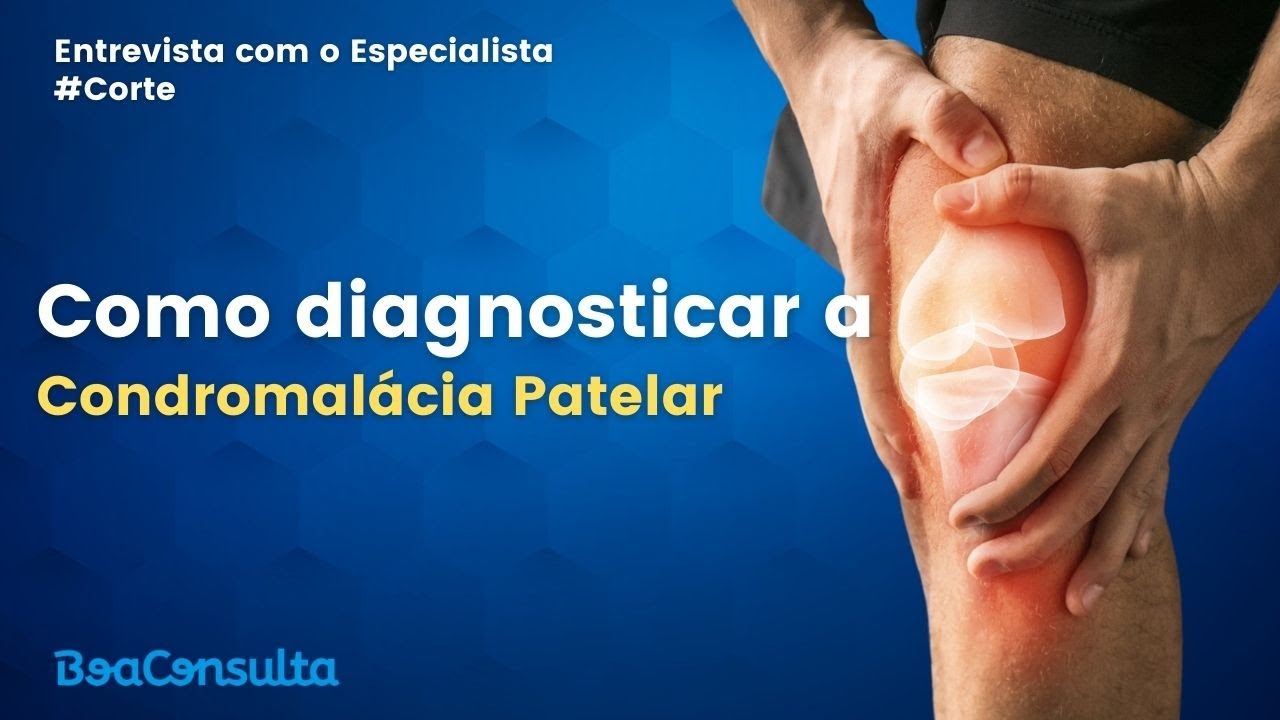 Especialista explicando como fazer o diagnóstico da Condromalácia Patelar.