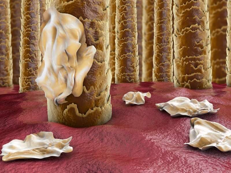 Ilustração dermatite seborreica.