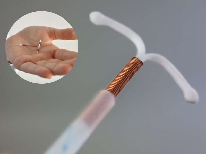 Foto aproximada do DIU dispositivo intrauterino.