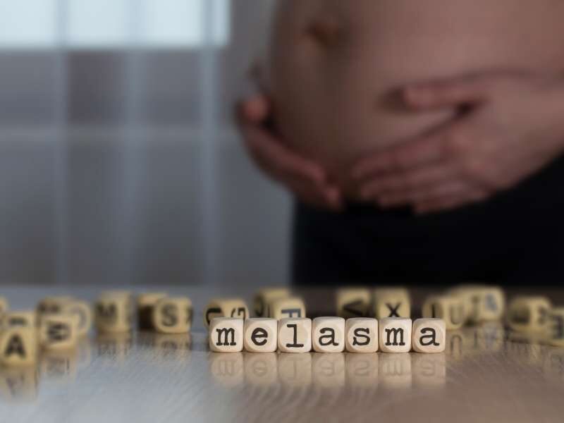 Mulher gravida com melasma.