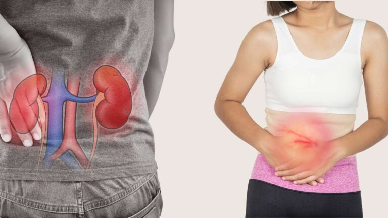 Diferença entre pedra na vesícula e cálculo renal.