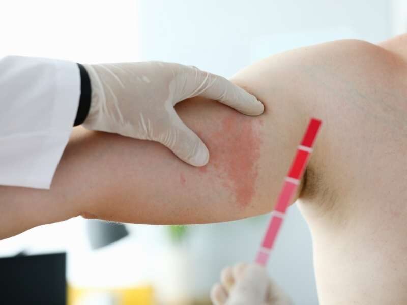 Médico examinando assadura em paciente.