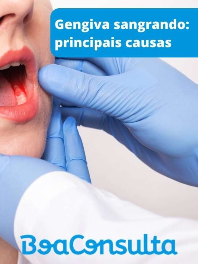 Sangramento na Gengiva: conheça 10 causas comuns – BoaConsulta