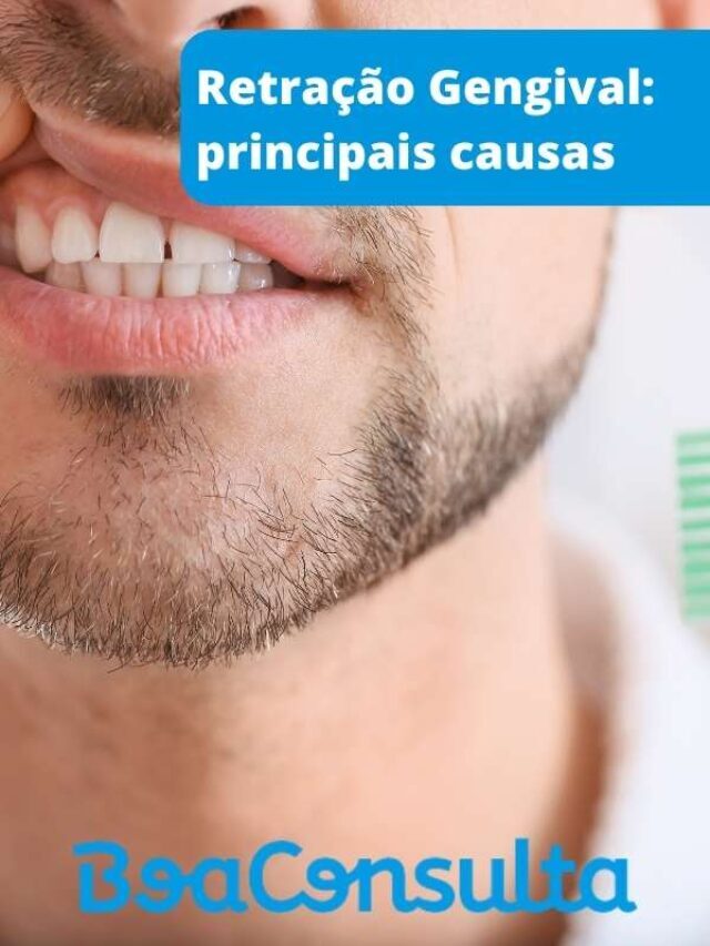 Conheça as causas da retração gengival – BoaConsulta