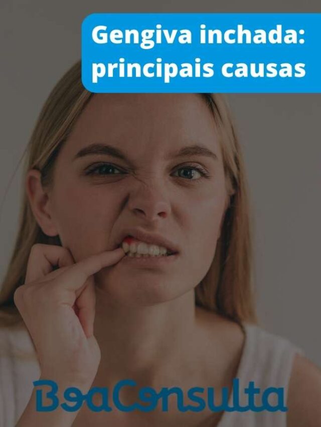 Gengiva inchada: quais são as principais causas? - BoaConsulta