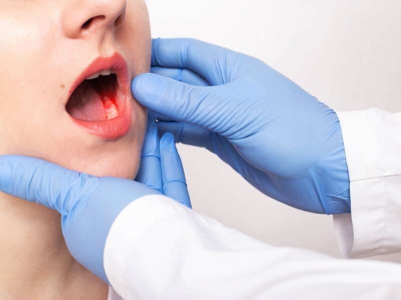 Dentista avaliando quadro de gengivite.