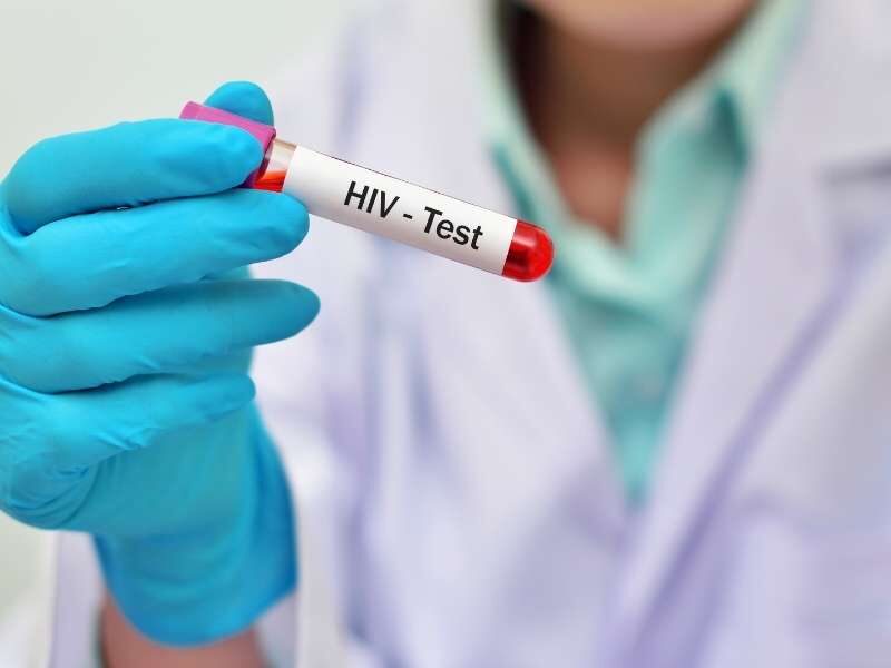 Amostragem Sanguínea de exame de HIV.