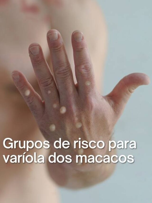 Quem são os grupos de risco da varíola do macaco? – BoaConsulta