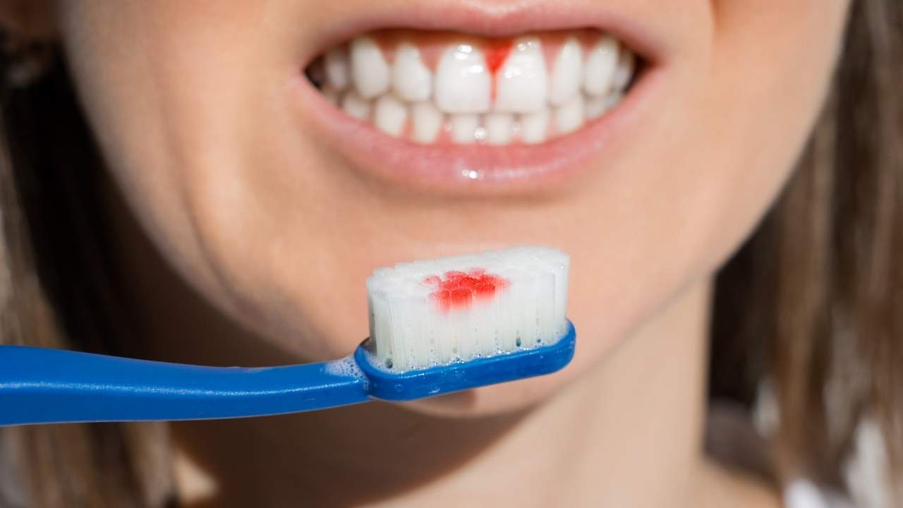 Mulher com gengivite segurando escova de dentes.