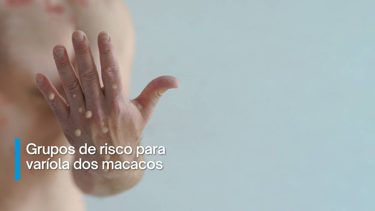 Grupos de riscos para varíola dos macacos.