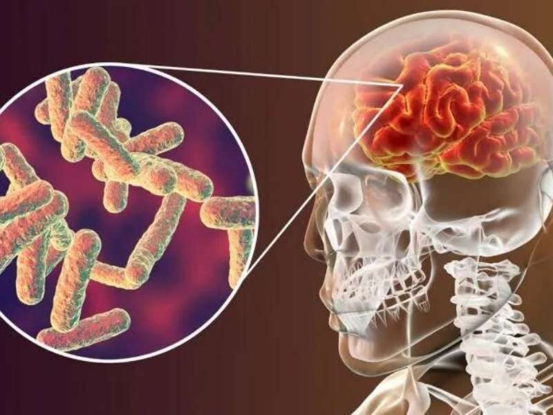 bactéria meningococo meningite.