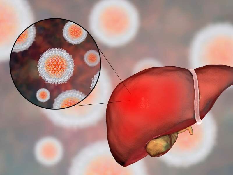 Fígado afetado com hepatite B e C.