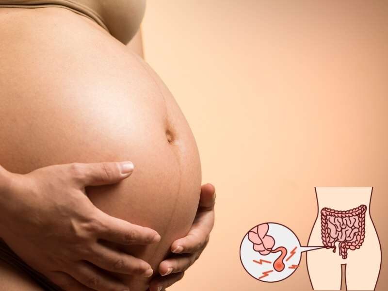 Sintomas de apendicite em gestantes.