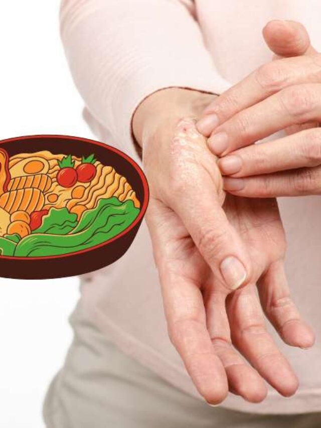 O que uma pessoa com psoríase não pode comer? – BoaConsulta