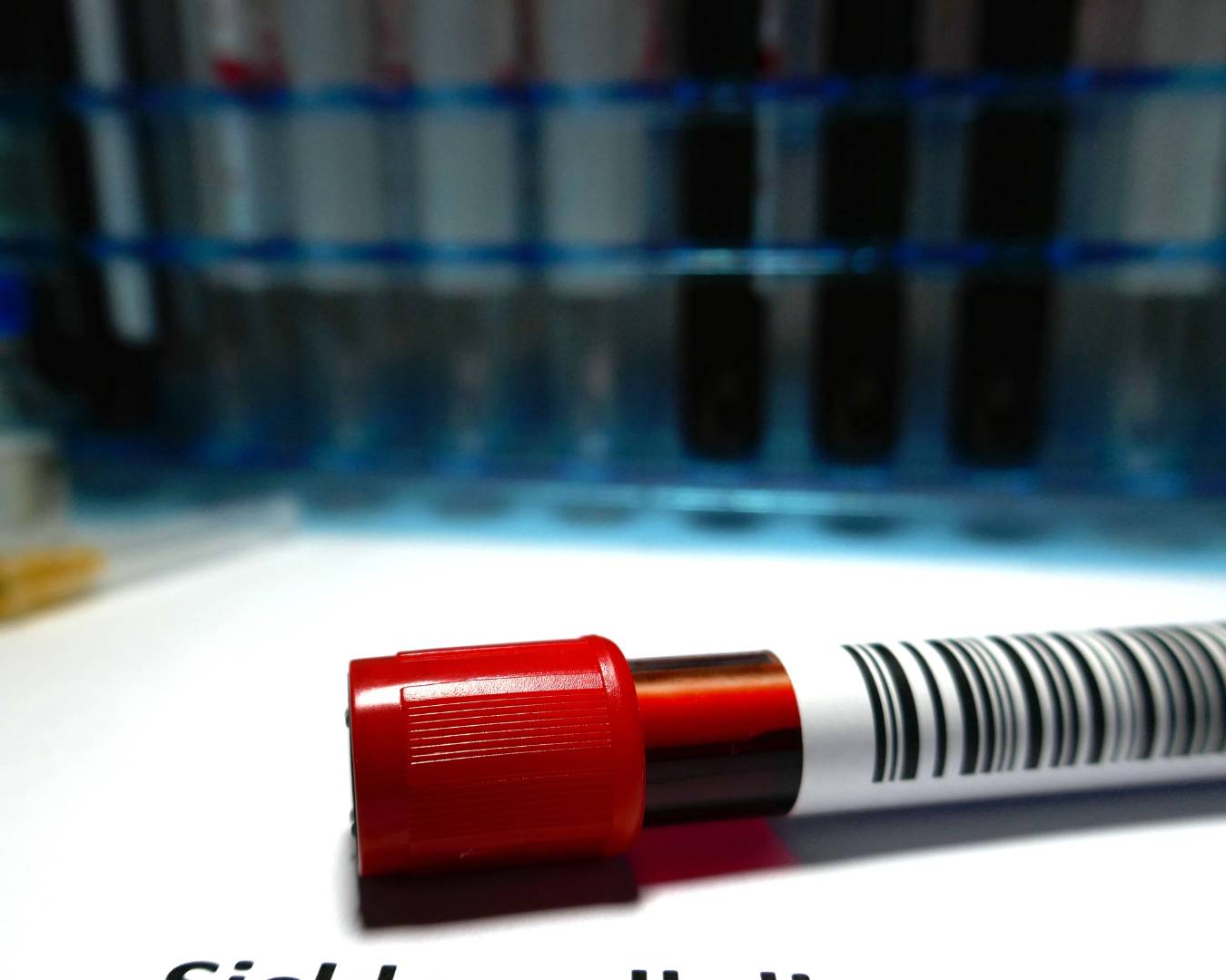 Anemia falciforme e leucemia. Aprenda a diferenciar e os mitos sobre uma patologia evoluir para a outra