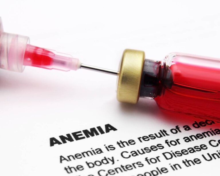 Entenda o que é a anemia falciforme, como diagnosticar e tratar essa doença
