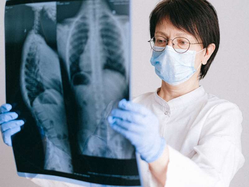 Médica analisando radiográfia do torax.
