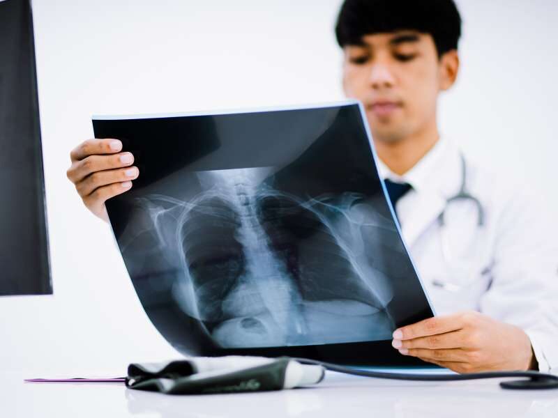 Médico olhando radiográfica do tórax.