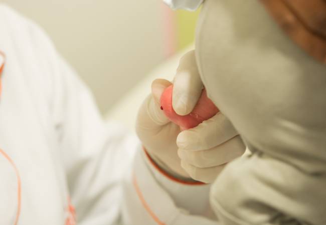 A detecção da doença pode ser feito nos primeiros instantes de vida