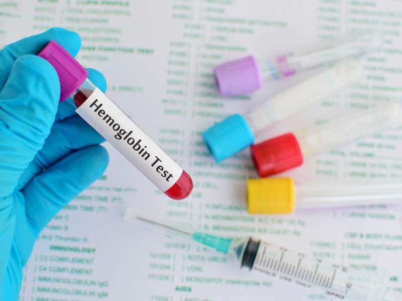 Amostra de sangue para exame de Eletroforese de hemoglobina.