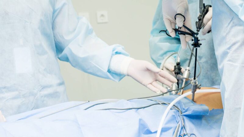 Cirurgia Laparoscópica.