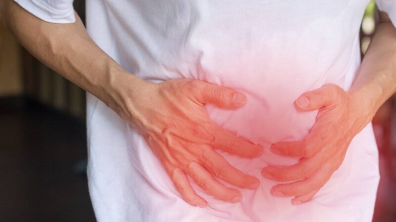 Hérnia Inguinal.