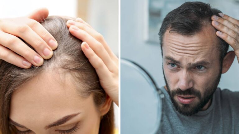 Causas da queda de cabelo.