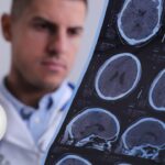 Esclerose Múltipla: o que é, Sintomas, Causas e Tratamento.