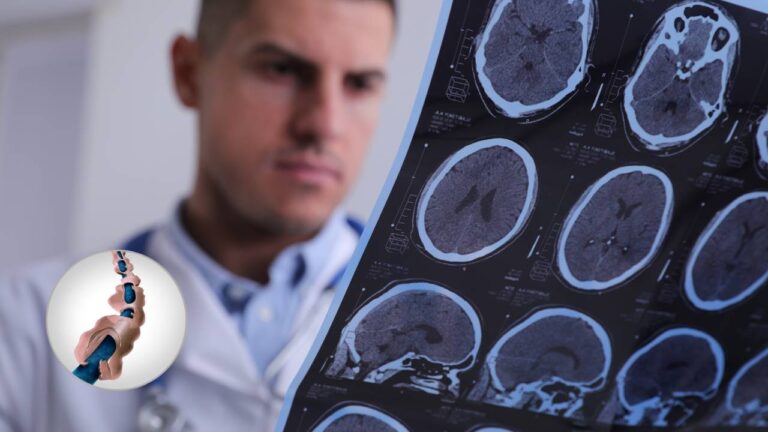 Esclerose Múltipla: o que é, Sintomas, Causas e Tratamento.
